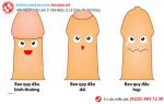 Dài bao quy đầu và những điều nam giới cần phải biết