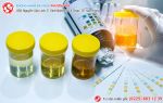 Xét nghiệm nước tiểu đơn giản, nhanh chóng nhưng phát hiện nhiều bệnh sớm