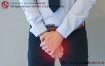 Apxe tinh hoàn, chớ dại chủ quan
