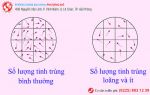 Tinh trùng loãng có sao không