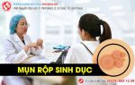 Mụn rộp sinh dục là gì? Có nguy hiểm không?
