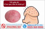 Nổi Mẩn Đỏ Ở Bao Quy Đầu Là Dấu Hiệu Bệnh Gì?