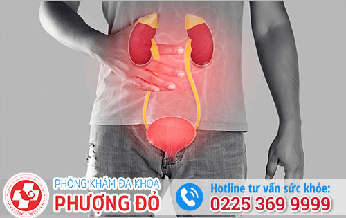 Tiểu buốt ở nam giới dấu hiệu của nhiều bệnh lý nguy hiểm