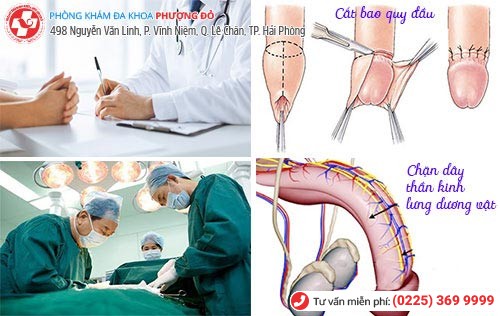 Những phương pháp chữa yếu sinh lý nam hiệu quả hiện nay