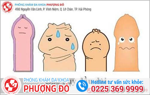 Dấu Hiệu Nhận Biết Bao Quy Đầu Dài