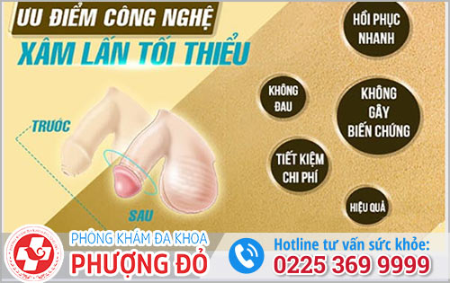 Bao Quy Đầu Thì Phải Làm Sao Để Khắc Phục?