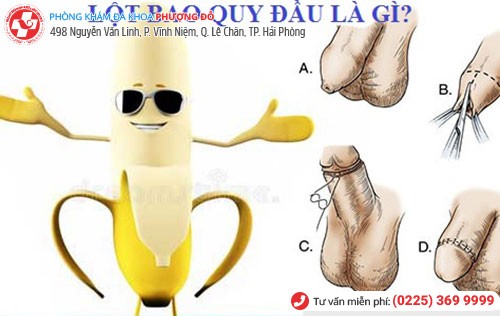 Lột bao quy đầu mang lại nhiều lợi ích cho nam giới