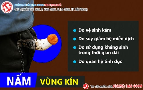 Làm sao để thoát khỏi bệnh nấm vùng kín ở nam giới?