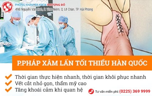 Tổng quan dây hãm bao quy đầu nam giới nên biết