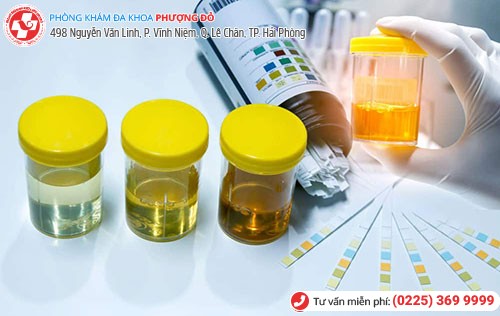 Xét nghiệm nước tiểu giúp phát hiện nhiều bệnh