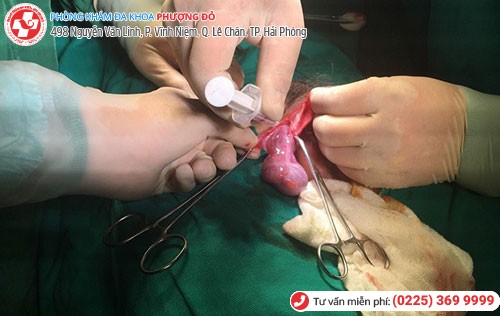 Bệnh nhân được phẫu thuật tháo xoắn tinh hoàn tại Phượng Đỏ