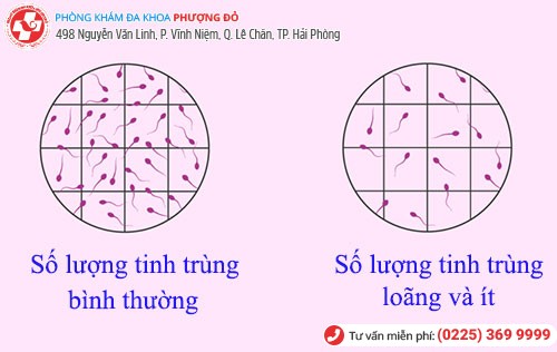 Tinh trùng bị loãng