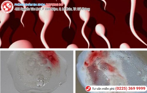 Nguyên nhân tinh trùng lẫn máu