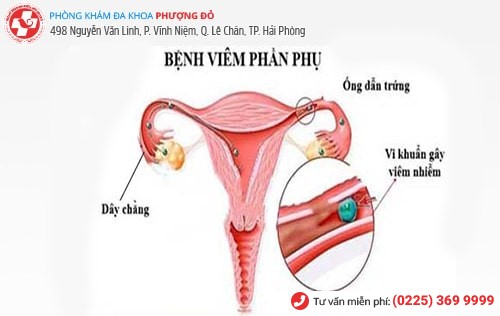 Tất tần tật những kiến thức mà chị em nên biết về bệnh phụ khoa Tất tần tật những kiến thức mà chị em nên biết về bệnh phụ khoa