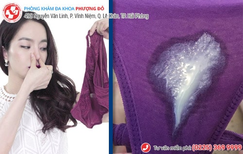 3 lý do khiến âm đạo ra nhiều huyết trắng 3 lý do khiến âm đạo ra nhiều huyết trắng