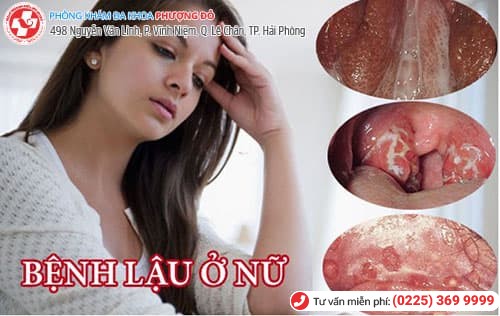 bệnh lậu ở nữ