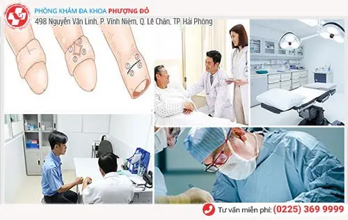 Cắt bao quy đầu tại Thái Bình địa chỉ uy tín mức phí bình dân