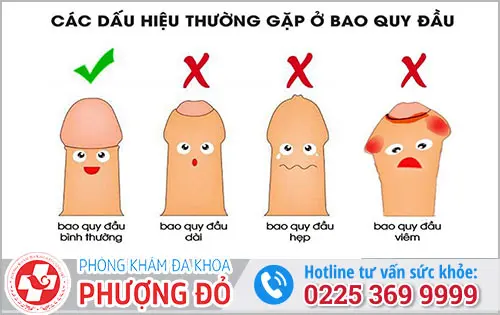 Cắt bao quy đầu mang lại nhiều lợi ích cho sức khỏe nam khoa